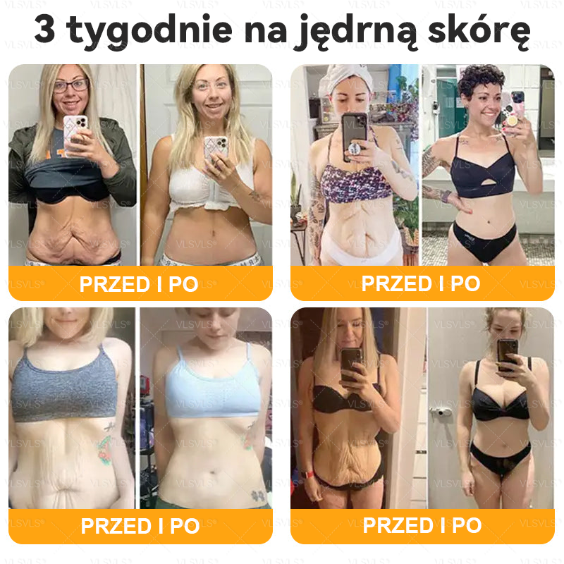 Wykonane i wysłane z Polski 👩‍⚕️👩‍⚕️ VLSVLS® Krem z Jadem Pszczoły Kompleksowy Ostatni Dzień 80% ZNIŻKI (Opadająca Skóra, Drobne Zmarszczki, Utrata Jędrności, Płaskie Piersi, Opadające Biodra i Więcej)