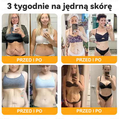 Wykonane i wysłane z Polski 👩‍⚕️👩‍⚕️ VLSVLS® Krem z Jadem Pszczoły Kompleksowy Ostatni Dzień 80% ZNIŻKI (Opadająca Skóra, Drobne Zmarszczki, Utrata Jędrności, Płaskie Piersi, Opadające Biodra i Więcej)