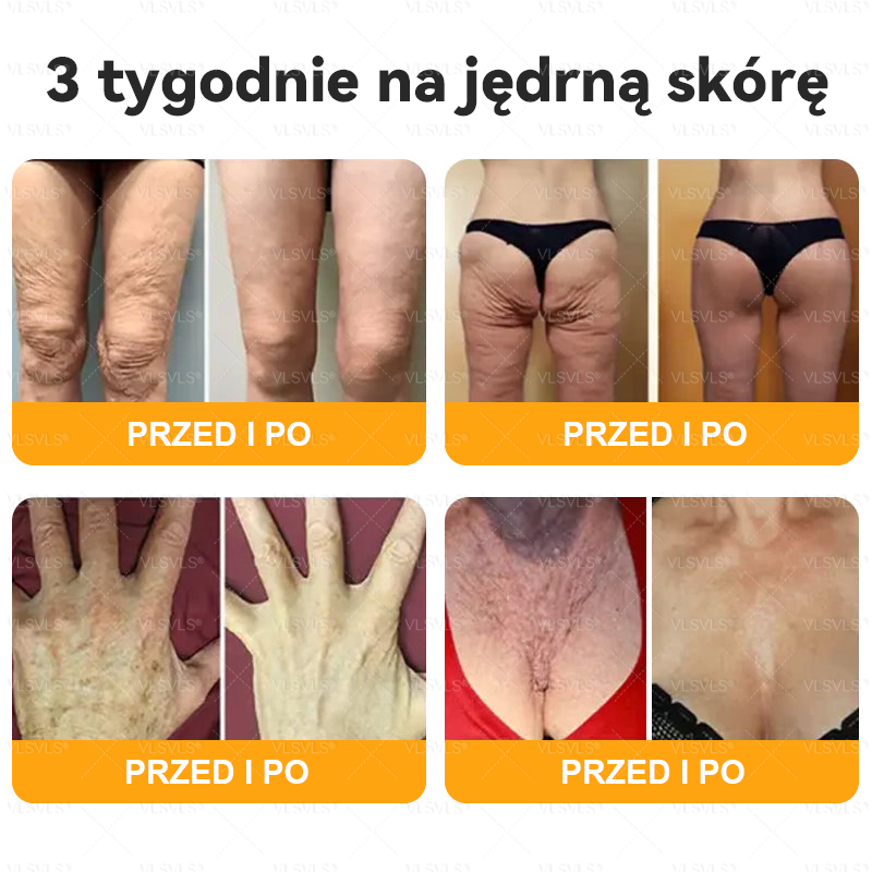 Wykonane i wysłane z Polski 👩‍⚕️👩‍⚕️ VLSVLS® Krem z Jadem Pszczoły Kompleksowy Ostatni Dzień 80% ZNIŻKI (Opadająca Skóra, Drobne Zmarszczki, Utrata Jędrności, Płaskie Piersi, Opadające Biodra i Więcej)