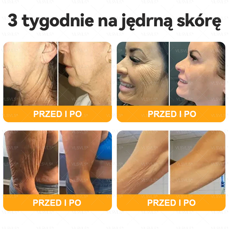 Wykonane i wysłane z Polski 👩‍⚕️👩‍⚕️ VLSVLS® Krem z Jadem Pszczoły Kompleksowy Ostatni Dzień 80% ZNIŻKI (Opadająca Skóra, Drobne Zmarszczki, Utrata Jędrności, Płaskie Piersi, Opadające Biodra i Więcej)