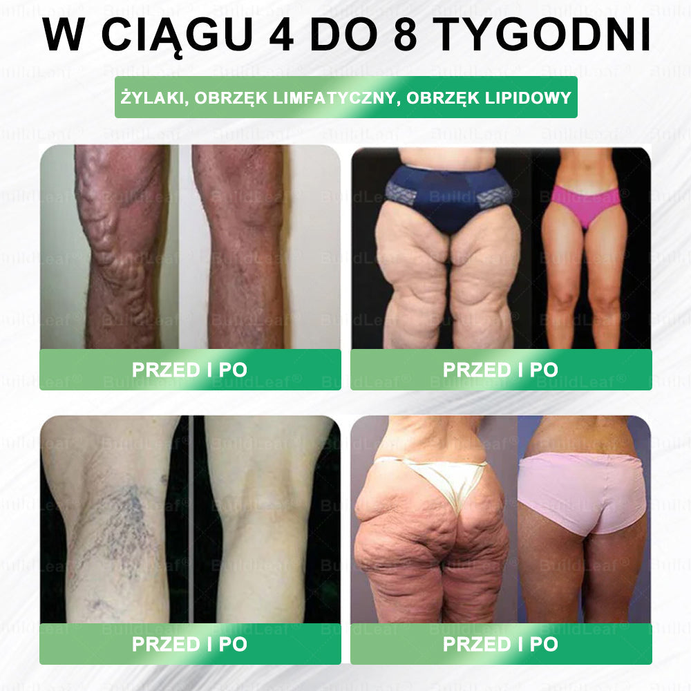 🌿Oficjalny sklep Polska | ⏰ BuildLeaf® GLP-1 8-w-1 Fit & Vital Rozwiązanie (Jednorazowe dziennie, widoczne zmiany w ciągu 7 dni) ✅ Otyłość, zdrowie sercowo-naczyniowe, cukrzyca, bezdech senny, zdrowie jelit, problemy ze stawami i inne.