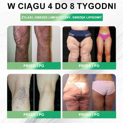 🌿Oficjalny sklep Polska | ⏰ BuildLeaf® GLP-1 8-w-1 Fit & Vital Rozwiązanie (Jednorazowe dziennie, widoczne zmiany w ciągu 7 dni) ✅ Otyłość, zdrowie sercowo-naczyniowe, cukrzyca, bezdech senny, zdrowie jelit, problemy ze stawami i inne.